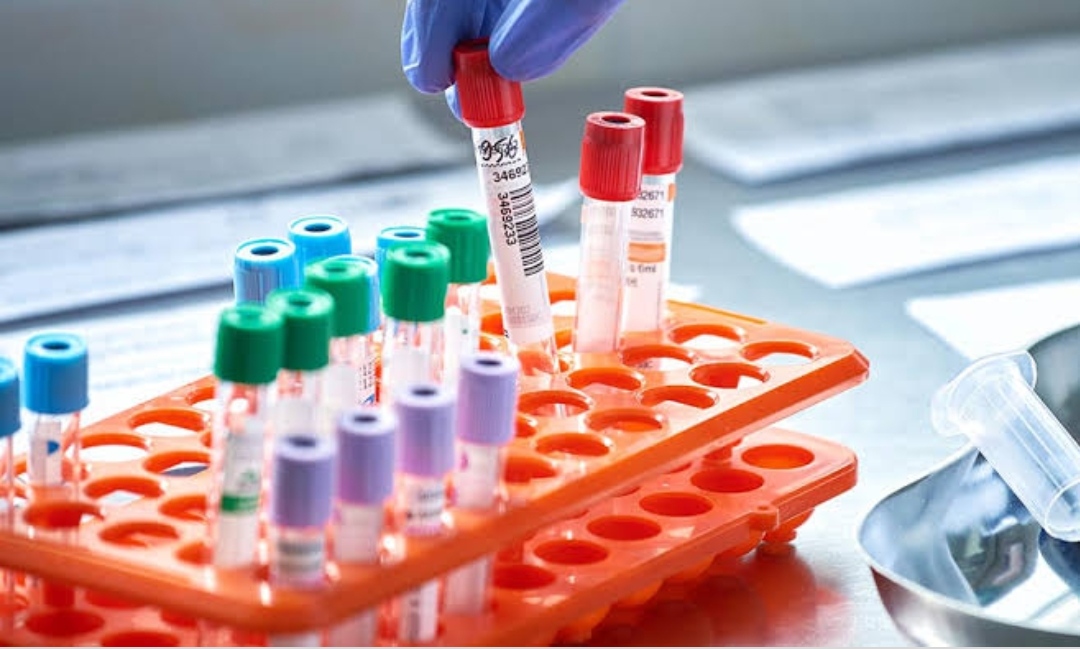 कोरोना वायरस का पहला प्लाज्मा परीक्षण देश में सफल रहा