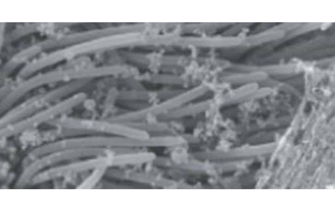 कोरोना होने के बाद ऐसा दिखाता है COVID-19 वायरस, पहली बार तस्वीर आई सामने